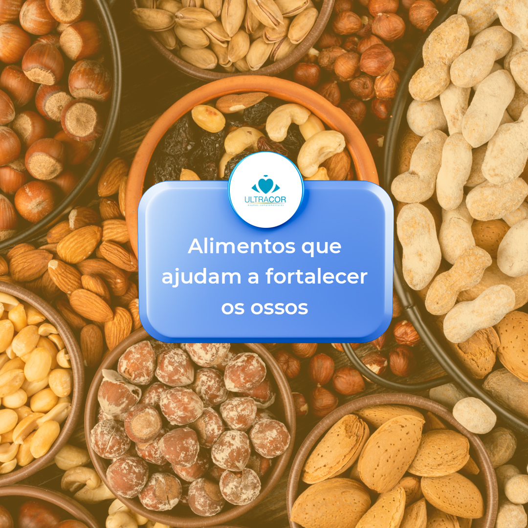 Sementes de Chia e Linhaça: Pequenas Gigantes Nutritivas - inspiração 1