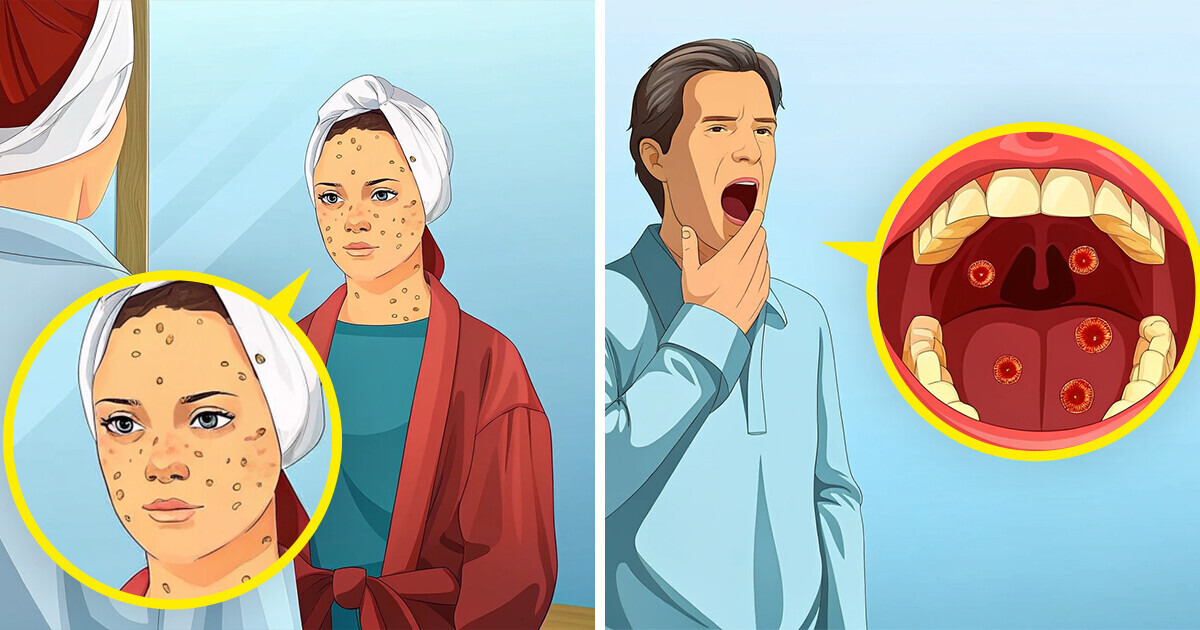 Sintomas em Adultos: Variações e Intensidade - inspiração 3