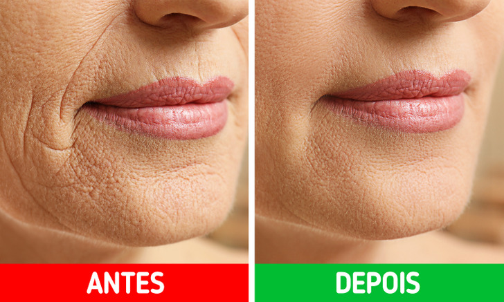 Como identificar os sinais de alergia à soja e o que fazer - inspiração 1