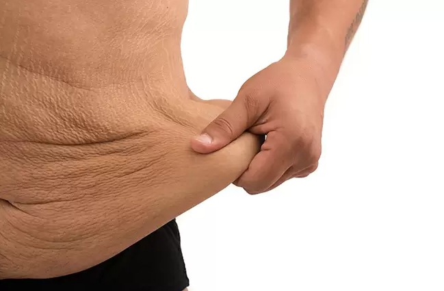 Diferenças entre 'Pó Bariátrico' e Suplementos Comuns - inspiração 1