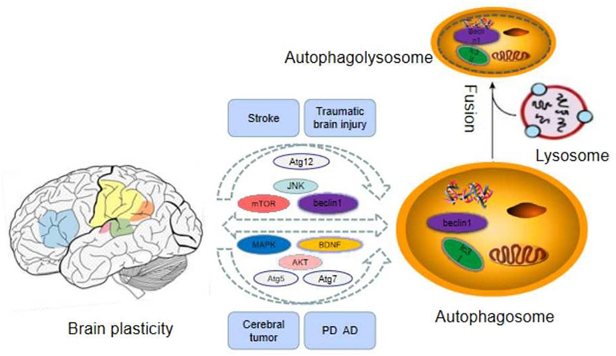 benefícios do jejum para o cérebro