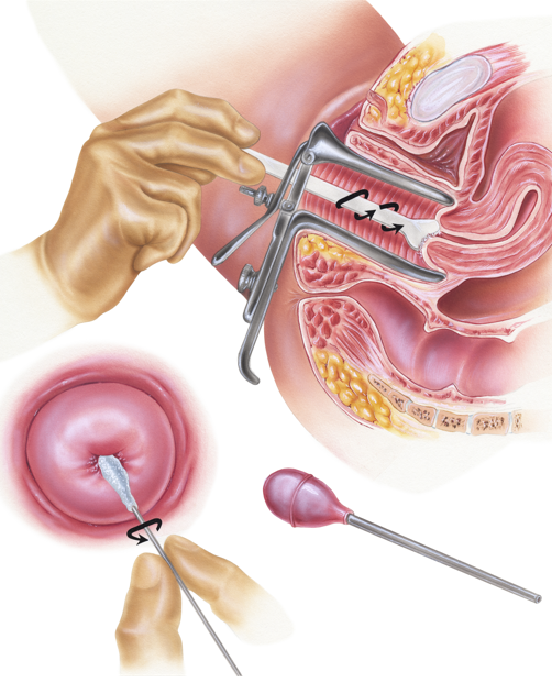 Guia Completo de Preparação para o Exame Preventivo