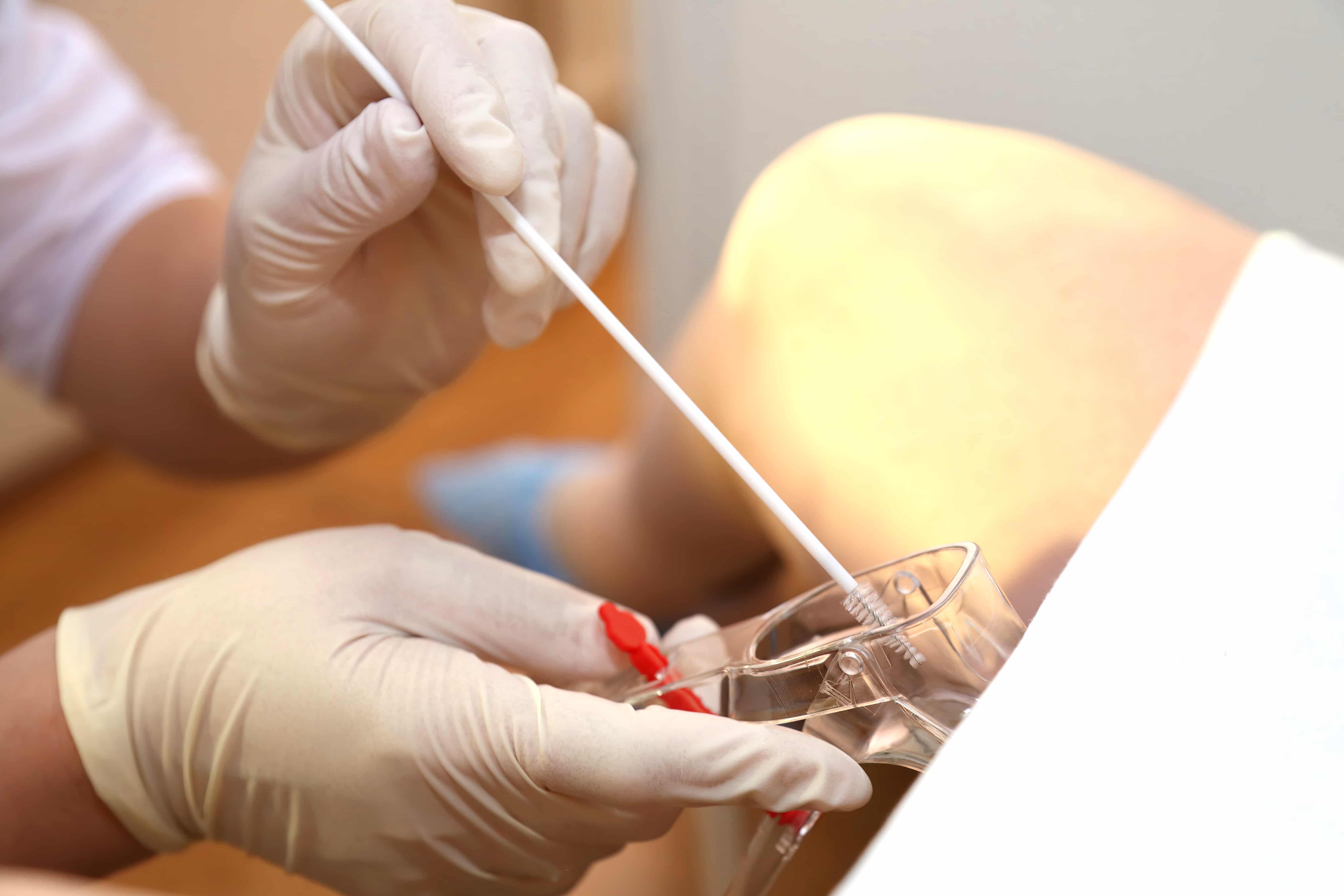 Papanicolau: Mitos e Verdades sobre o Exame Preventivo