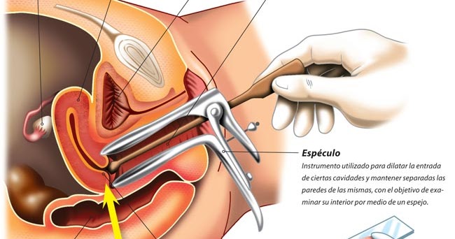 como fazer o papanicolau