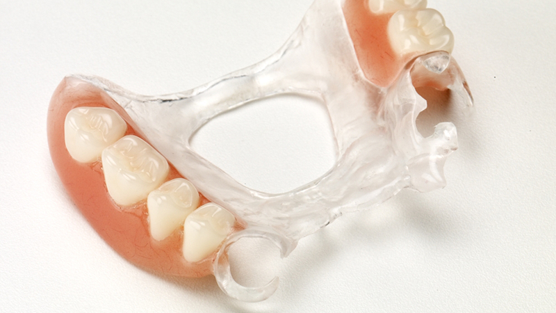 como fazer uma protese dentaria removivel