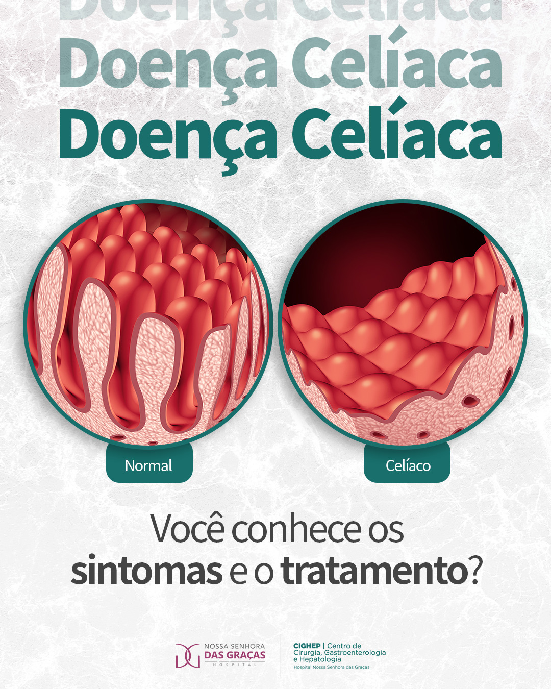 Sintomas Atípicos da Doença Celíaca: O Que Você Precisa Saber