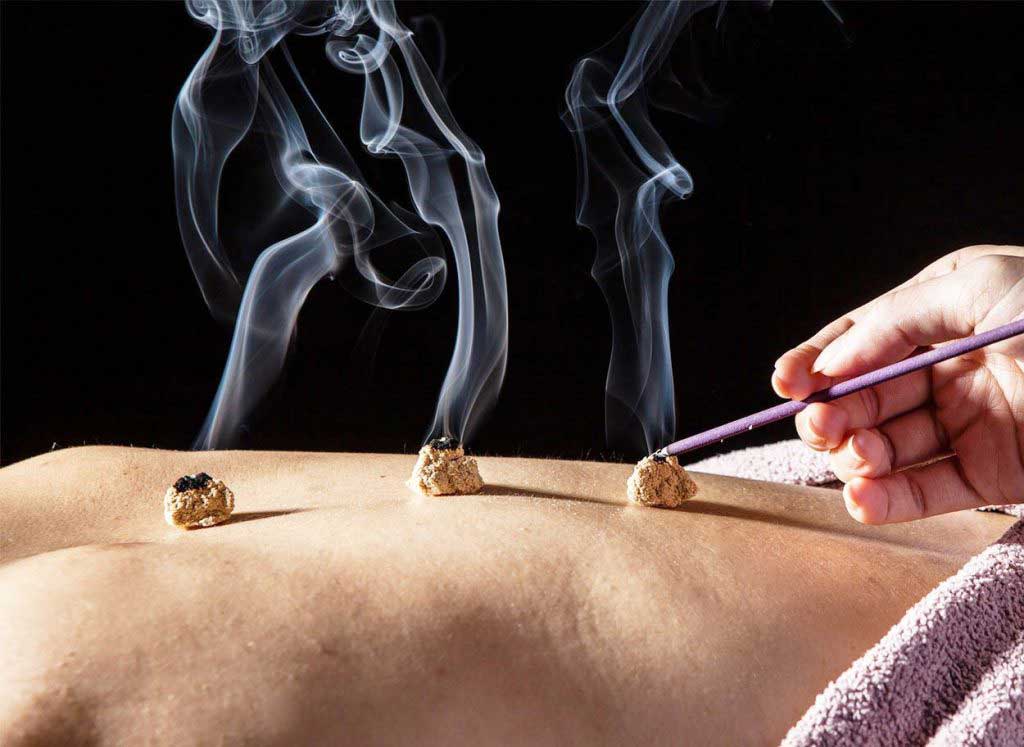 Riscos e Cuidados Essenciais ao Praticar Moxabustão em Casa