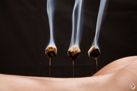 Guia Completo dos Benefícios da Moxabustão para Dores Crônicas