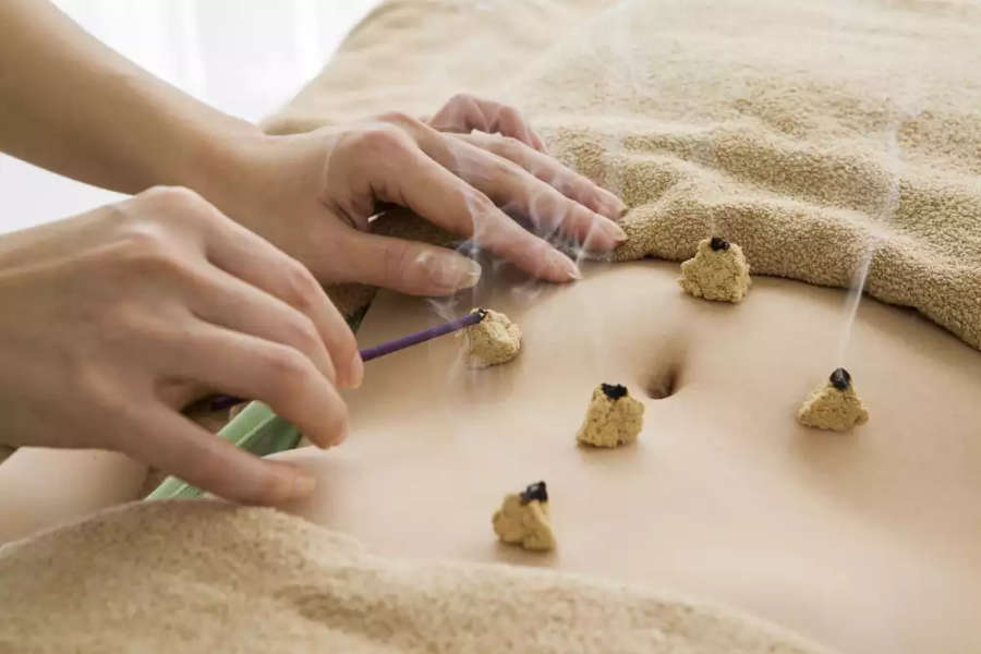 Moxabustão vs. Acupuntura: Qual a Diferença?