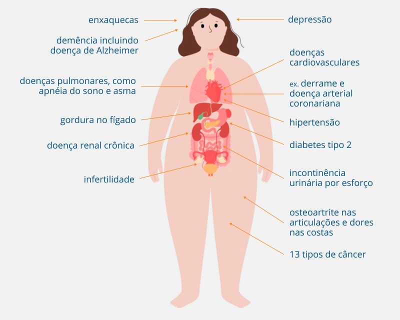 erros comuns ao tentar emagrecer